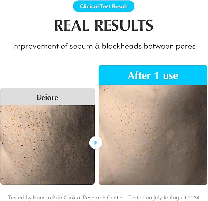 Swimming Pool Toner Pads - Dual-Textured Facial Toner Pads for Pore Care and Gentle Exfoliation | Boosted Hydration with Hyaluronic Acid | Korean Toner Pads for Face (70 Pads)