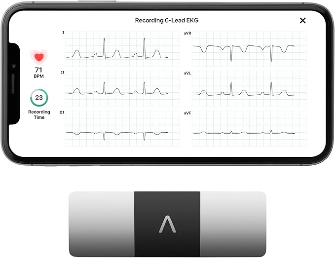 KardiaMobile 6-Lead Personal EKG Monitor – Six Views of The Heart – Detects AFib and Irregular Arrhythmias – Instant Results in 30 Seconds – Works with Most Smartphones