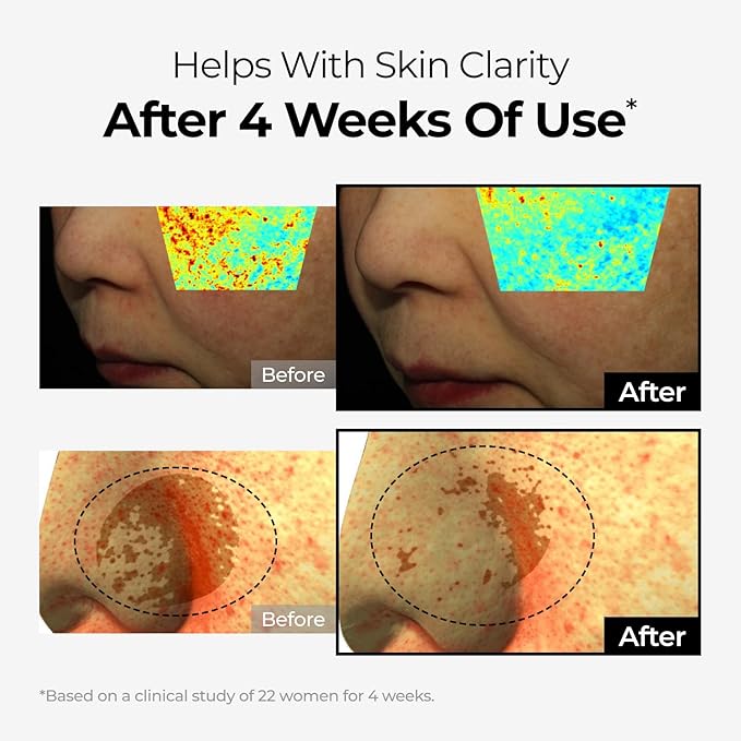 DOMINAS Niacinamide & Tranexamic Acid Cream | Korean Skincare for Even Skin Tone | With Bakuchiol & Panthenol (1.76oz)