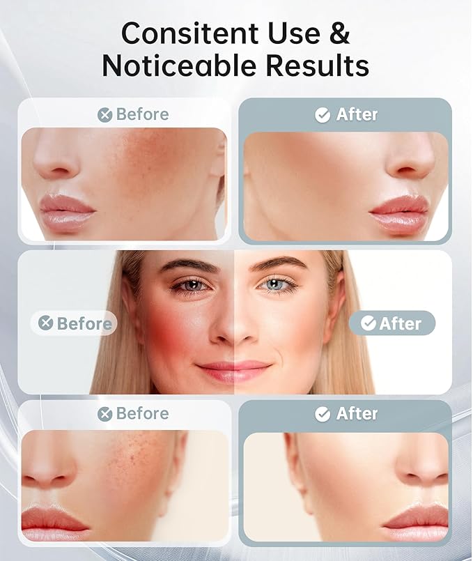 Red Light Therapy for Face and Neck, 7 Color Facial Massager with Adjustable Vibration and Thermals for Wrinkles, Double Chin, Portable Skin Care Tool with Base, White