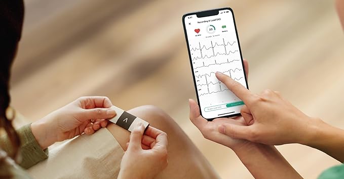 KardiaMobile 6-Lead Personal EKG Monitor – Six Views of The Heart – Detects AFib and Irregular Arrhythmias – Instant Results in 30 Seconds – Works with Most Smartphones