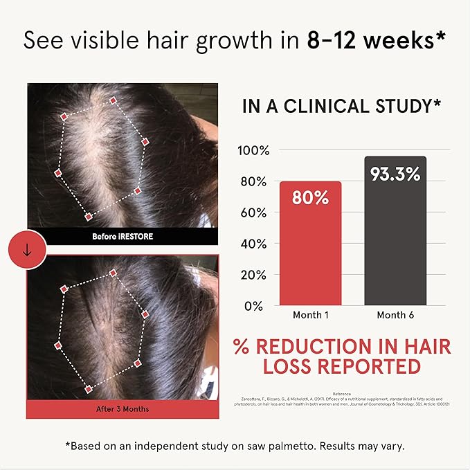 iRestore Hair Growth Supplement - Hair Loss Vitamins for Women and Men - Biotin Multivitamins & DHT Blocker to Reduce Hair Thinning - Hair Regrowth Pills - 30 Days Supply 90 Count (Pack of 1)