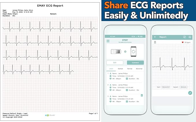 EMAY Portable ECG Monitor | Record ECG and Heart Rate | Compatible with Smartphone and PC